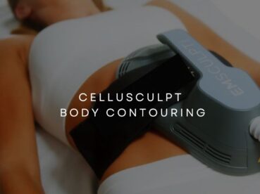 CELLUSCULPT BODY CONTOURING